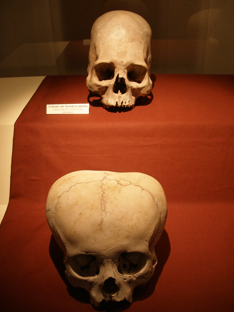 El canibalismo a través de la historia humana