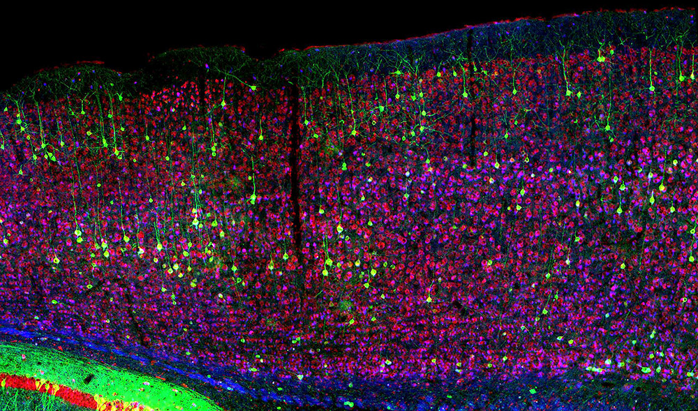 Neuronas humanas implantadas en cerebros de ratones abren debate