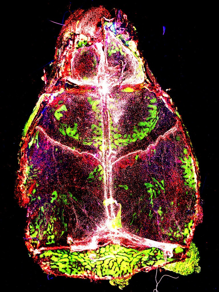 El Alzheimer podría iniciar fuera del cerebro, revela estudio