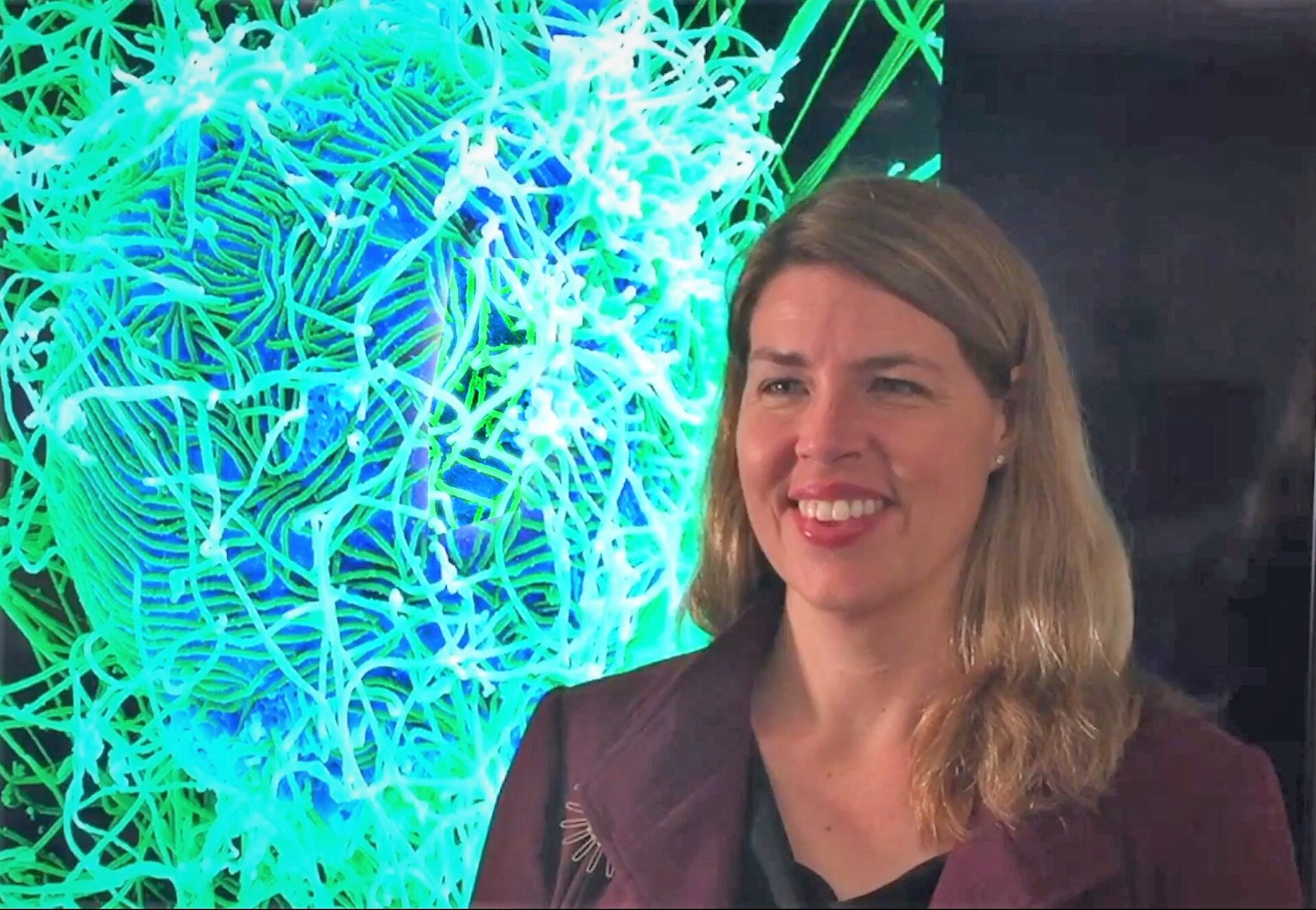 Startup usa virus diseñados por IA contra infección resistente