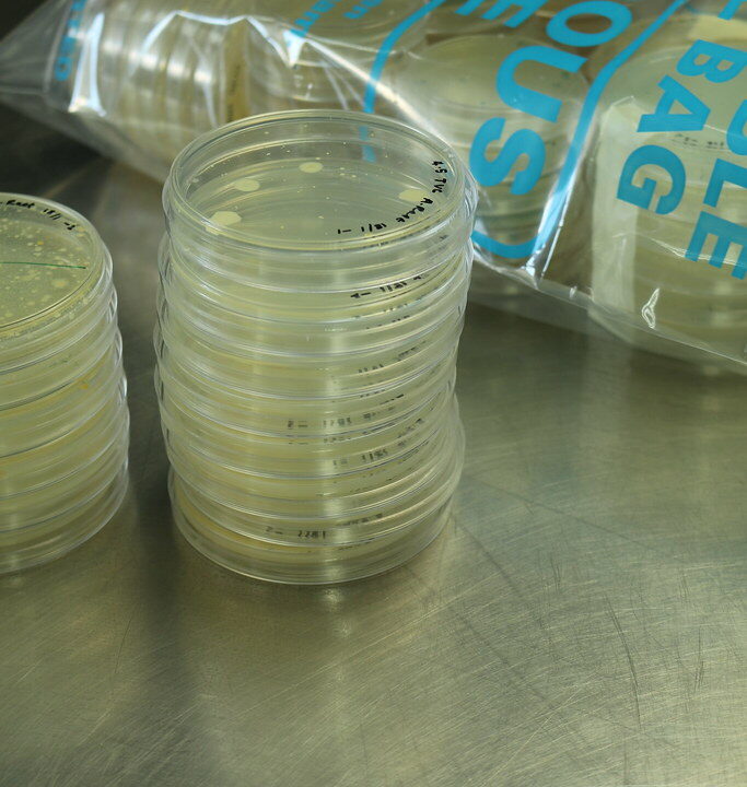 El misterio de los laboratorios antipeste rusos