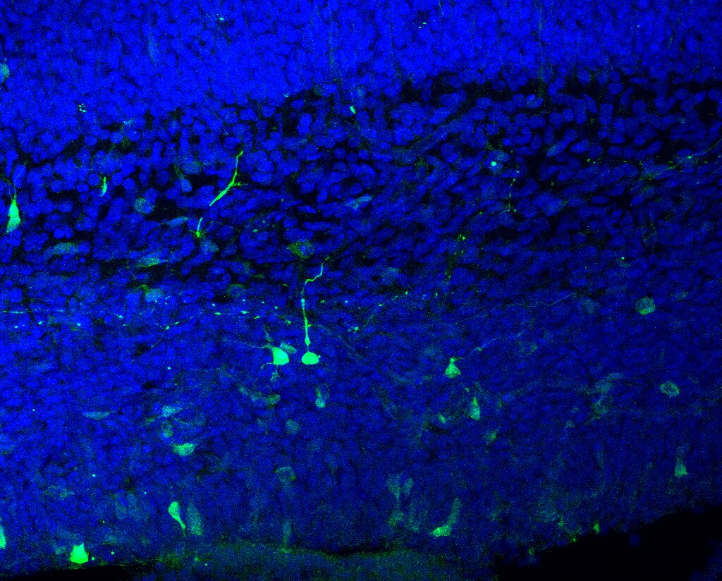 Nobel de Medicina premia descubrimientos sobre el cerebro