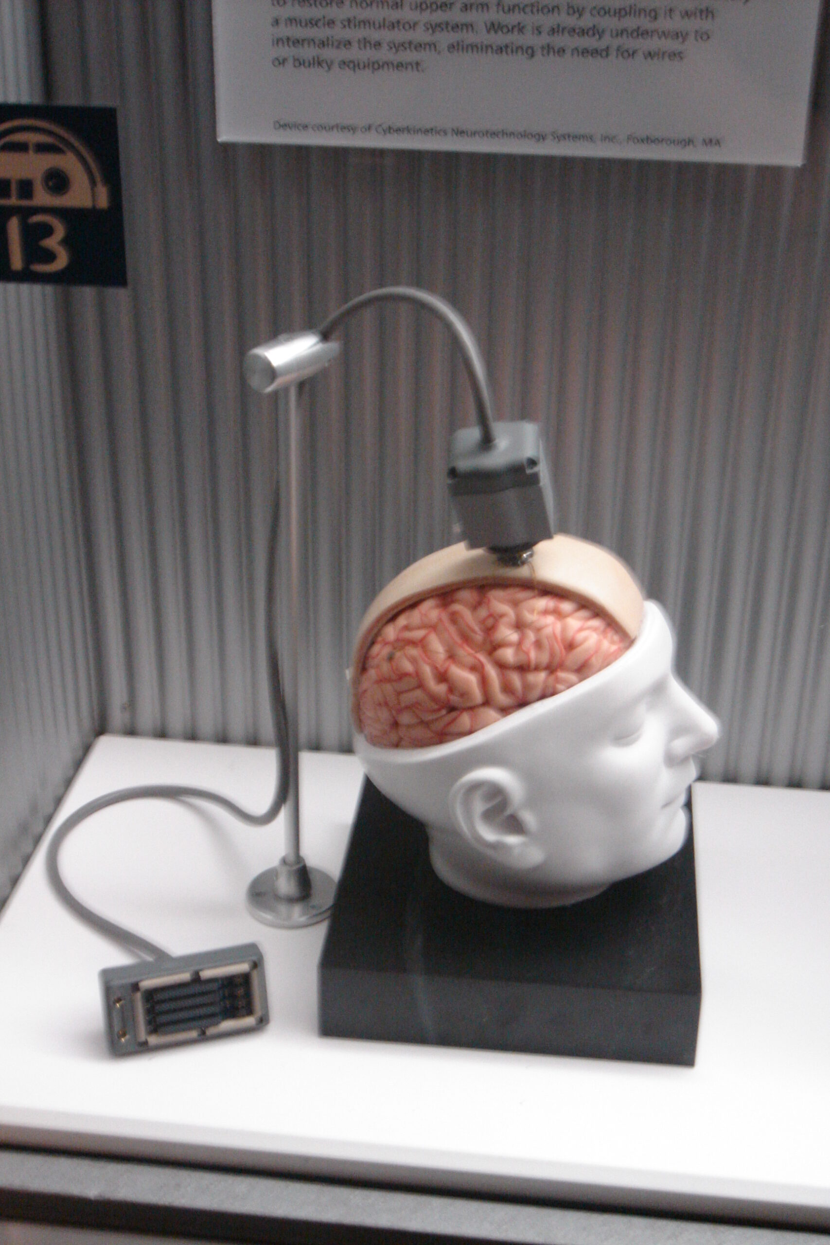 Imagen: PaulWicks at English Wikipedia. Implantes cerebrales que convierten pensamientos en voz