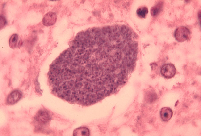 La malaria que azotó Inglaterra: ¿podría regresar?